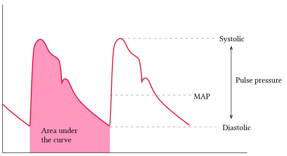 Arterial line tracing highlighting systolic, diastolic pressures, area under the curve and MAP